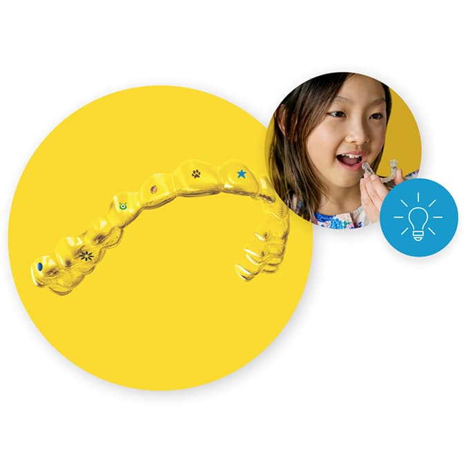 Ragazza che indossa gli stickable sugli aligner Invisalign®